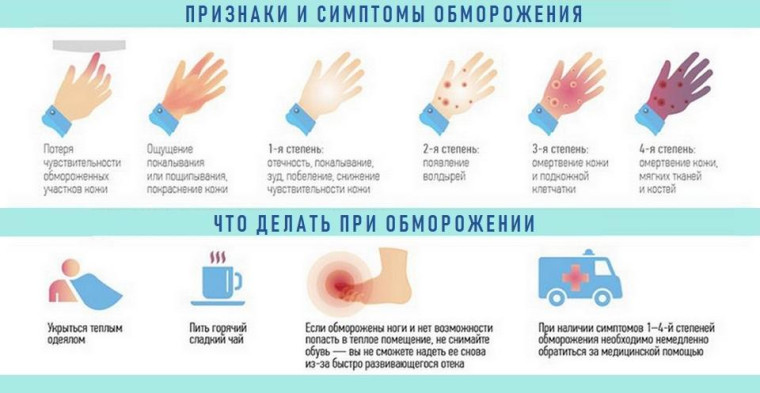 Информируем о профилактике обморожений. Информируем о профилактике обморожений.
